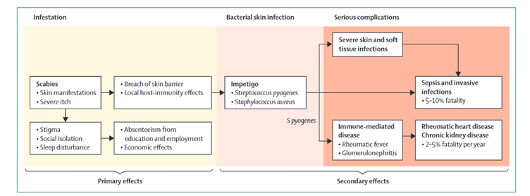 Consequences of scabies infection. Lancet. 2019 Jul 6;394(10192):81-92. doi: 10.1016/S0140-6736(19)31136-5.